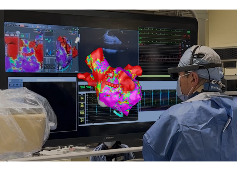 Dr. Musat using the CommandEP platform to visualize his next ablation site