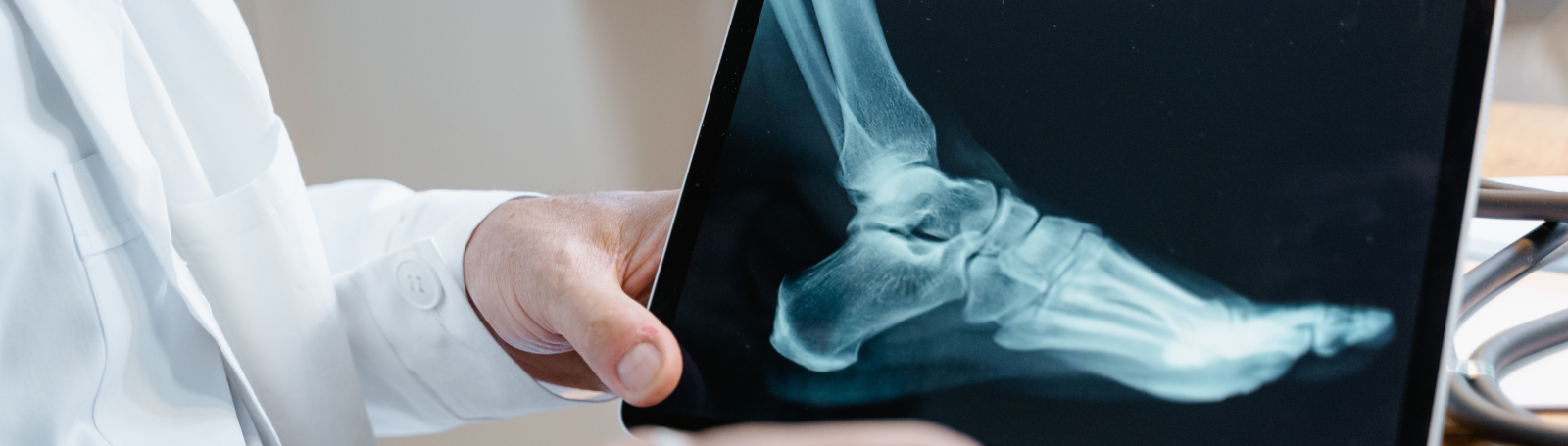 A doctor showing an x-ray image of a foot on a tablet