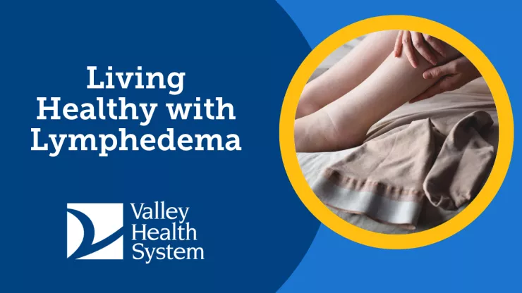 Living Healthy with Lymphedema